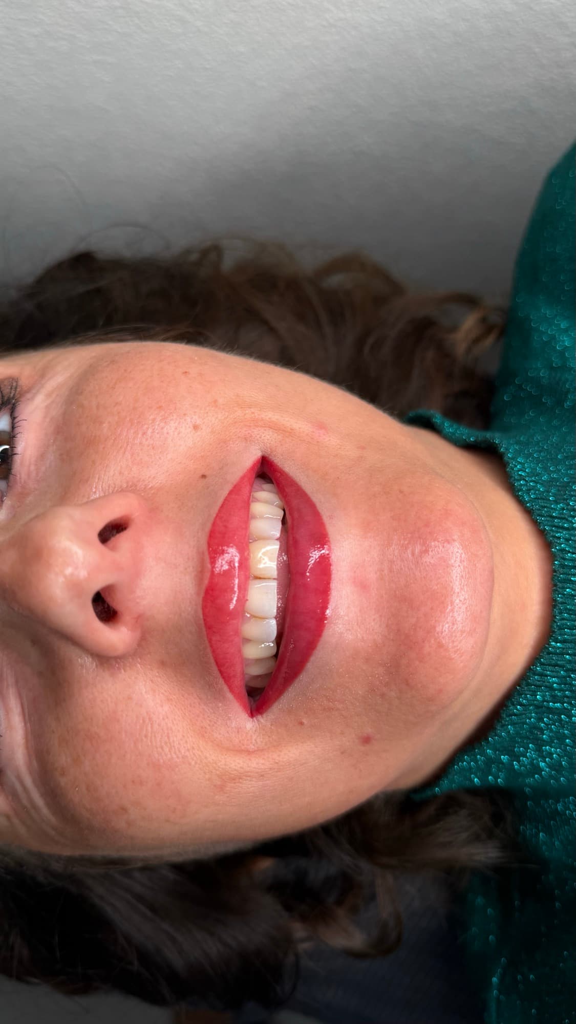 Dezelfde lippen na de lip blush, met kleur in de lip.